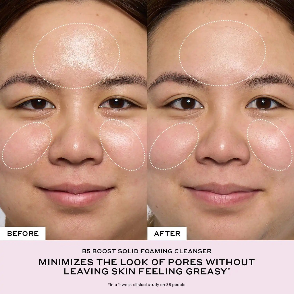 B5 Boost Solid Foaming Gentle Cleanser